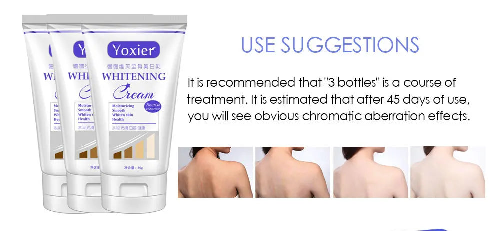 Yoxier Whitening Cream Moisturizing Nourish Repair Improve Arm Armpit Ankles Elbow Knee Body Dull Brighten Arbutin Skin Care 50g