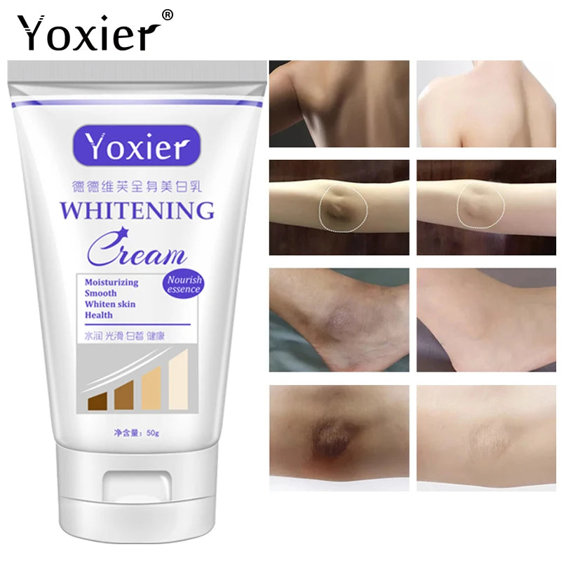 Yoxier Whitening Cream Moisturizing Nourish Repair Improve Arm Armpit Ankles Elbow Knee Body Dull Brighten Arbutin Skin Care 50g