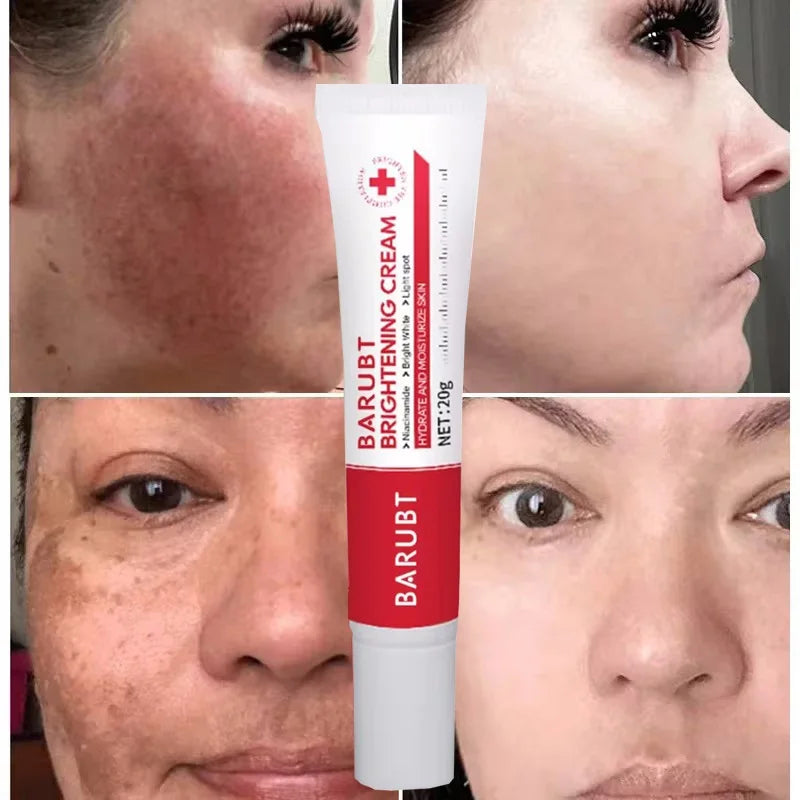 Powerful Spot-removing Whiten Cream Brighten Skin Fast Eliminates Melanin Pigmentation Melasma Dark Spots Moisturize Beauty Gel