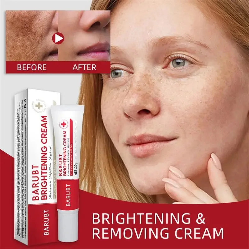 Powerful Spot-removing Whiten Cream Brighten Skin Fast Eliminates Melanin Pigmentation Melasma Dark Spots Moisturize Beauty Gel