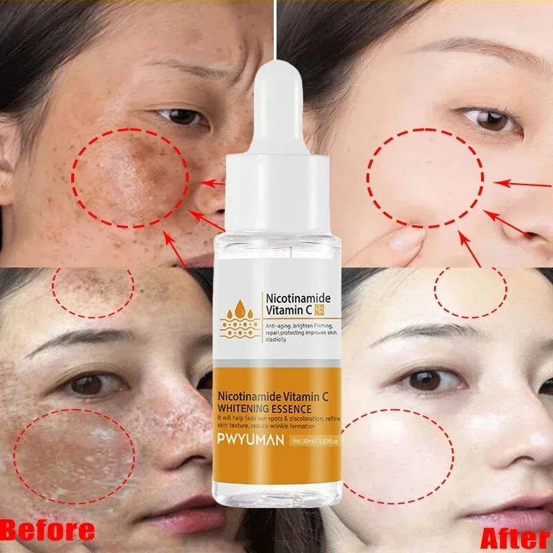 Powerful Dark Spots Remover Whitening Serum Face Freckle Melanin Correcting Anti Pigmentation Brighten Skin Beauty Care Products