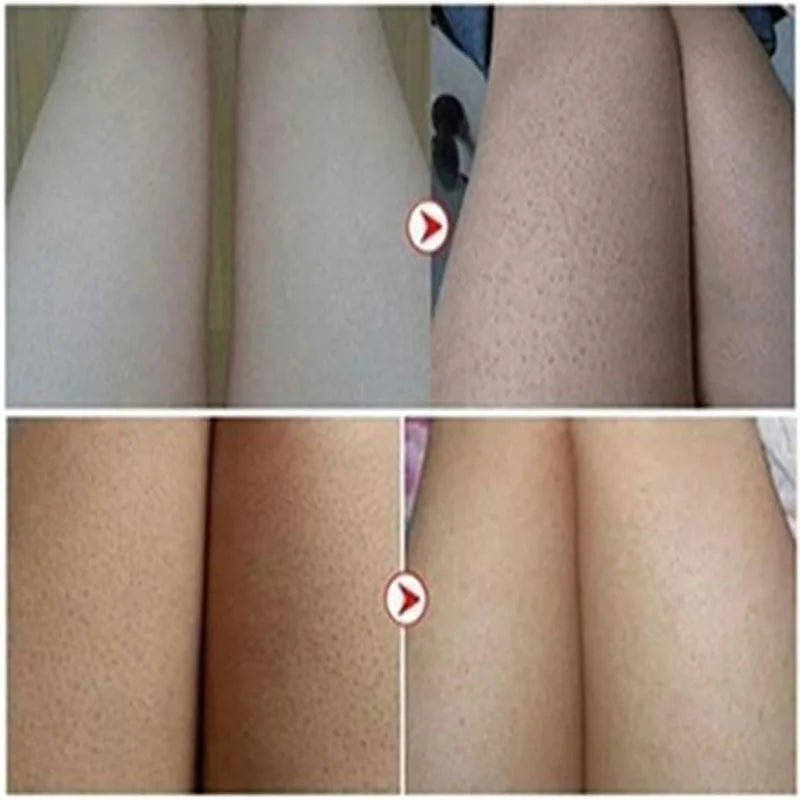 GlowBody Smoothing & Brightening Cream – Strawberry Legs & Rough Skin Fix