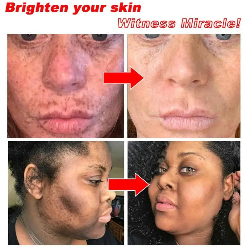 AstroGlow Dark Spot Corrector & Whitening Brightening Cream
