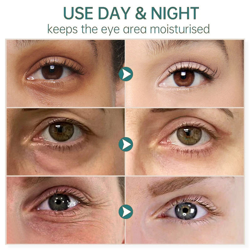 Eye Dark Circles Remover Cream Retinol Anti-aging Serum Remove Eye Bags Puffiness Fade Wrinkles Fine Lines Lift Firm Eye Care