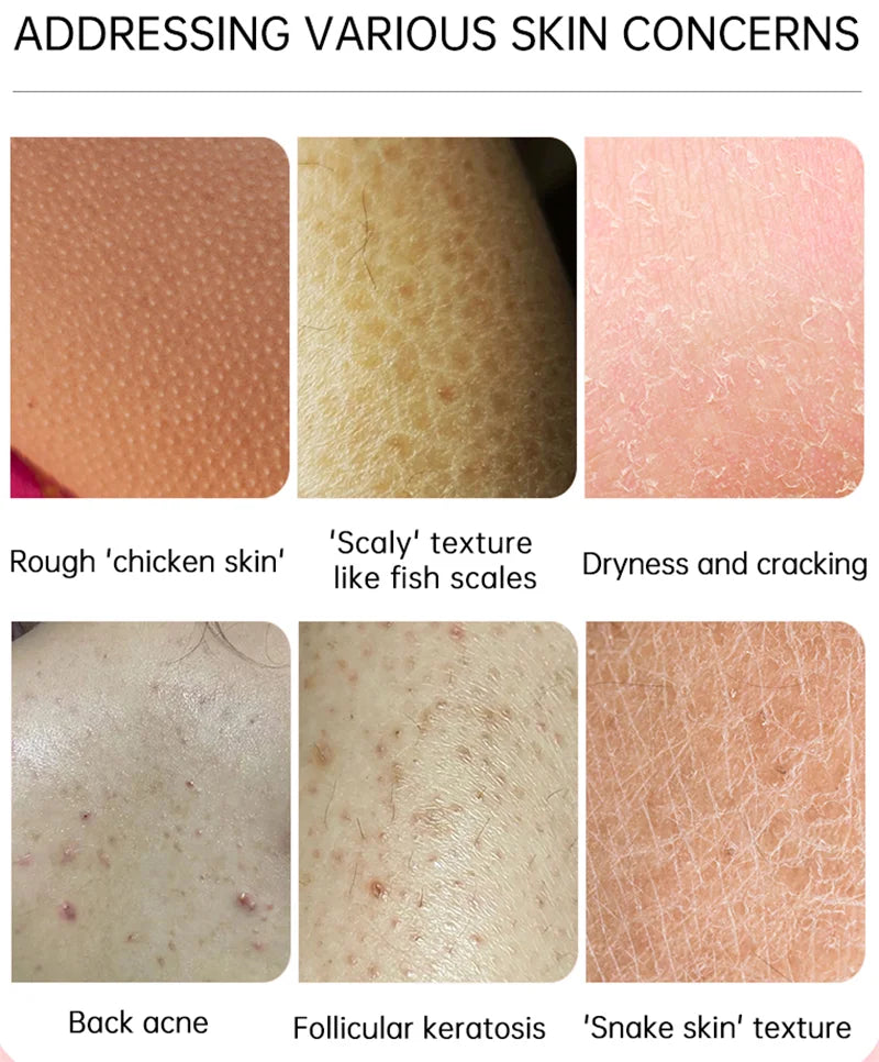 GlowBody Smoothing & Brightening Cream – Strawberry Legs & Rough Skin Fix