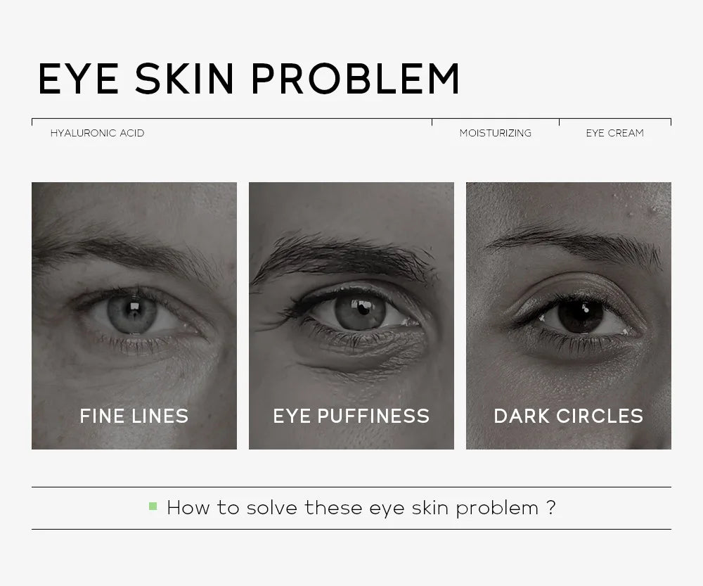 Eye Dark Circles Remover Cream Retinol Anti-aging Serum Remove Eye Bags Puffiness Fade Wrinkles Fine Lines Lift Firm Eye Care