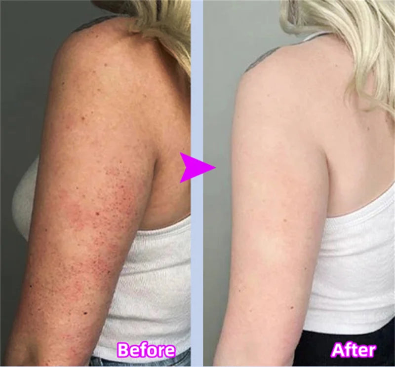 GlowBody Smoothing & Brightening Cream – Strawberry Legs & Rough Skin Fix