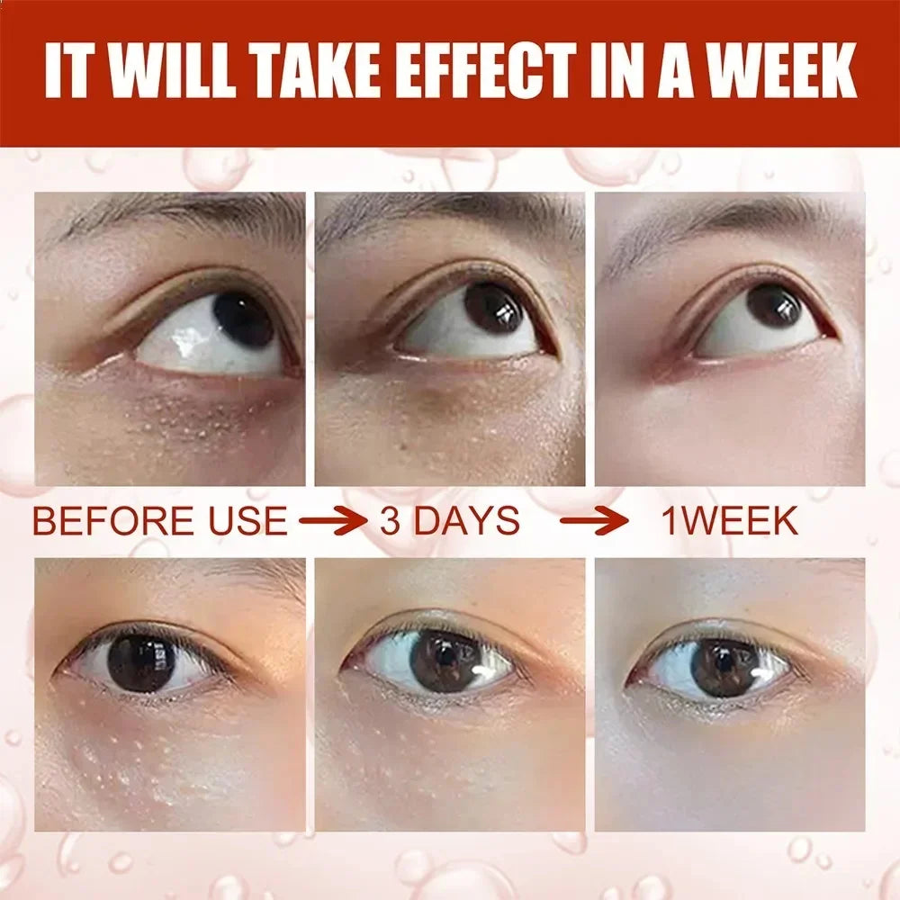 EyePure Fat Granule & Dark Circle Remover Eye Cream