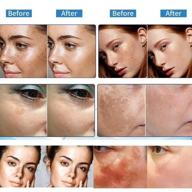 AstroGlow Dark Spot Corrector & Whitening Brightening Cream
