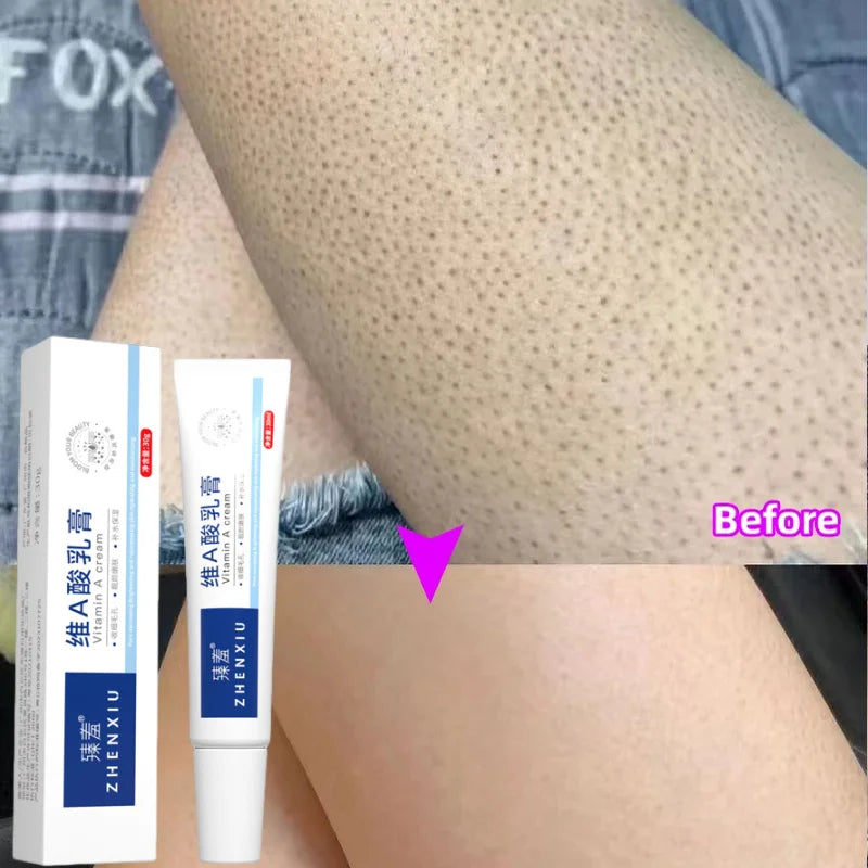 GlowBody Smoothing & Brightening Cream – Strawberry Legs & Rough Skin Fix