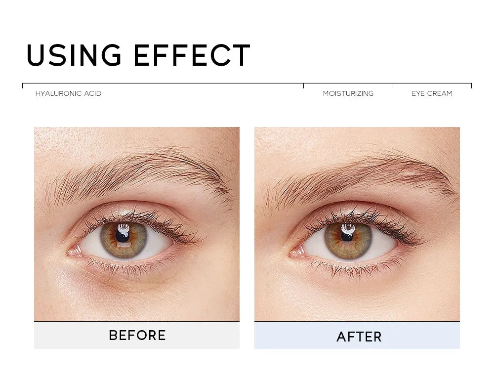 Eye Dark Circles Remover Cream Retinol Anti-aging Serum Remove Eye Bags Puffiness Fade Wrinkles Fine Lines Lift Firm Eye Care