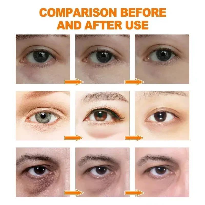 EyeRevive Retinol Dark Circle & Eye Bag Serum