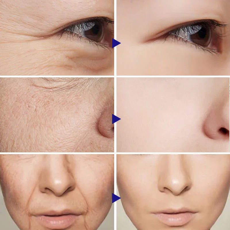 RetinolFirm Anti-Aging Wrinkle Repair Face Cream