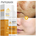 Powerful Dark Spots Remover Whitening Serum Face Freckle Melanin Correcting Anti Pigmentation Brighten Skin Beauty Care Products