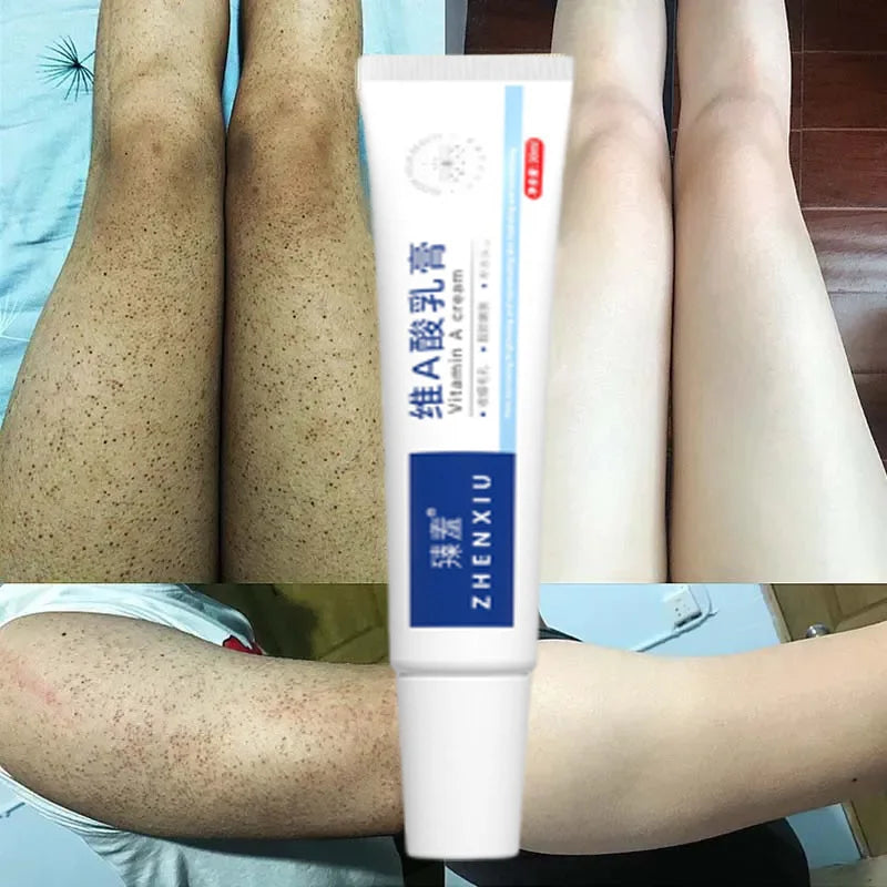 GlowBody Smoothing & Brightening Cream – Strawberry Legs & Rough Skin Fix