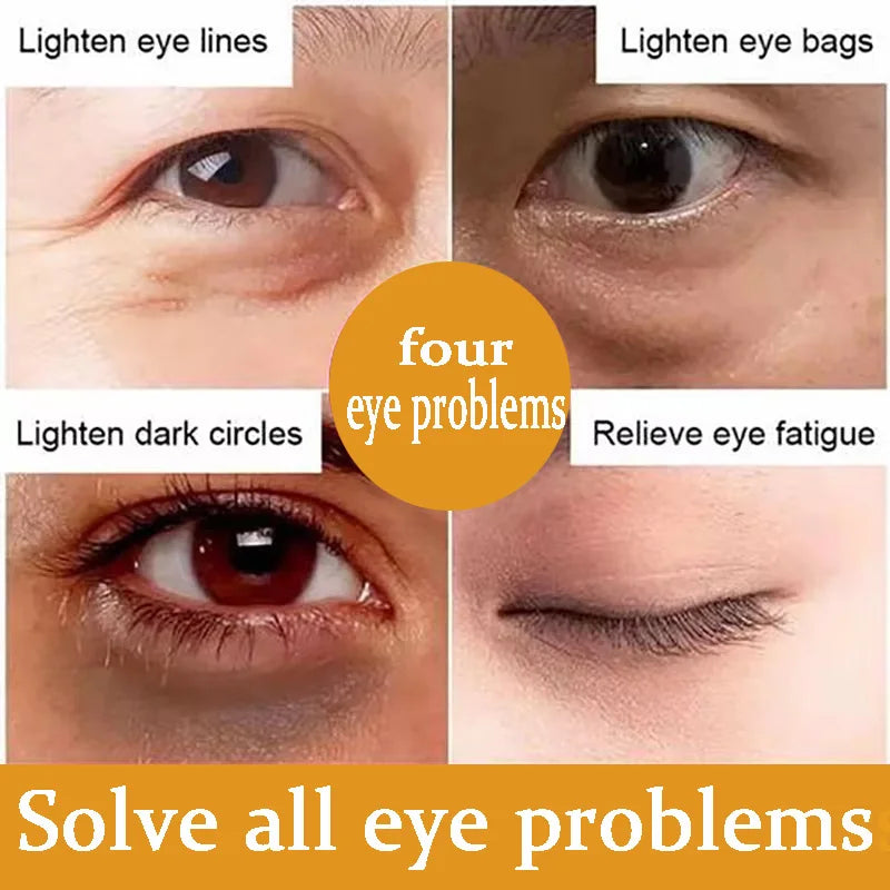 EyeRevive Retinol Dark Circle & Eye Bag Serum