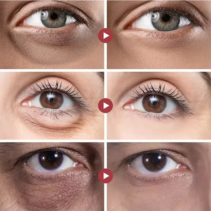 EyeRevive Retinol Dark Circle & Eye Bag Serum