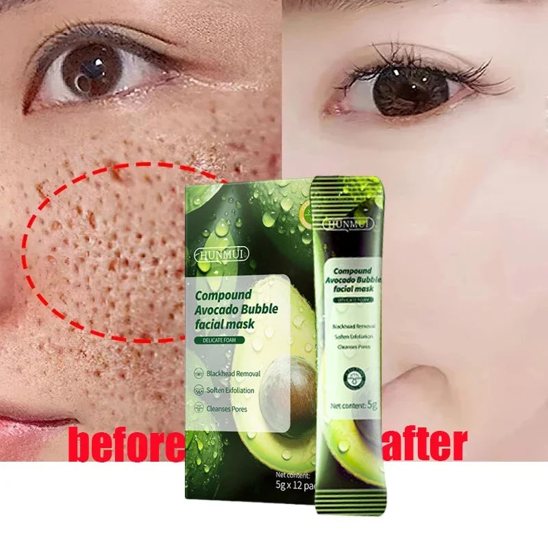 Salicylic Acid Pore Shrinking Mask Quick Elimination Large Pores Remove Blackehead Tighten Face Smooth Skin Korean Care Product