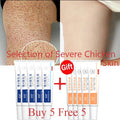 GlowBody Smoothing & Brightening Cream – Strawberry Legs & Rough Skin Fix