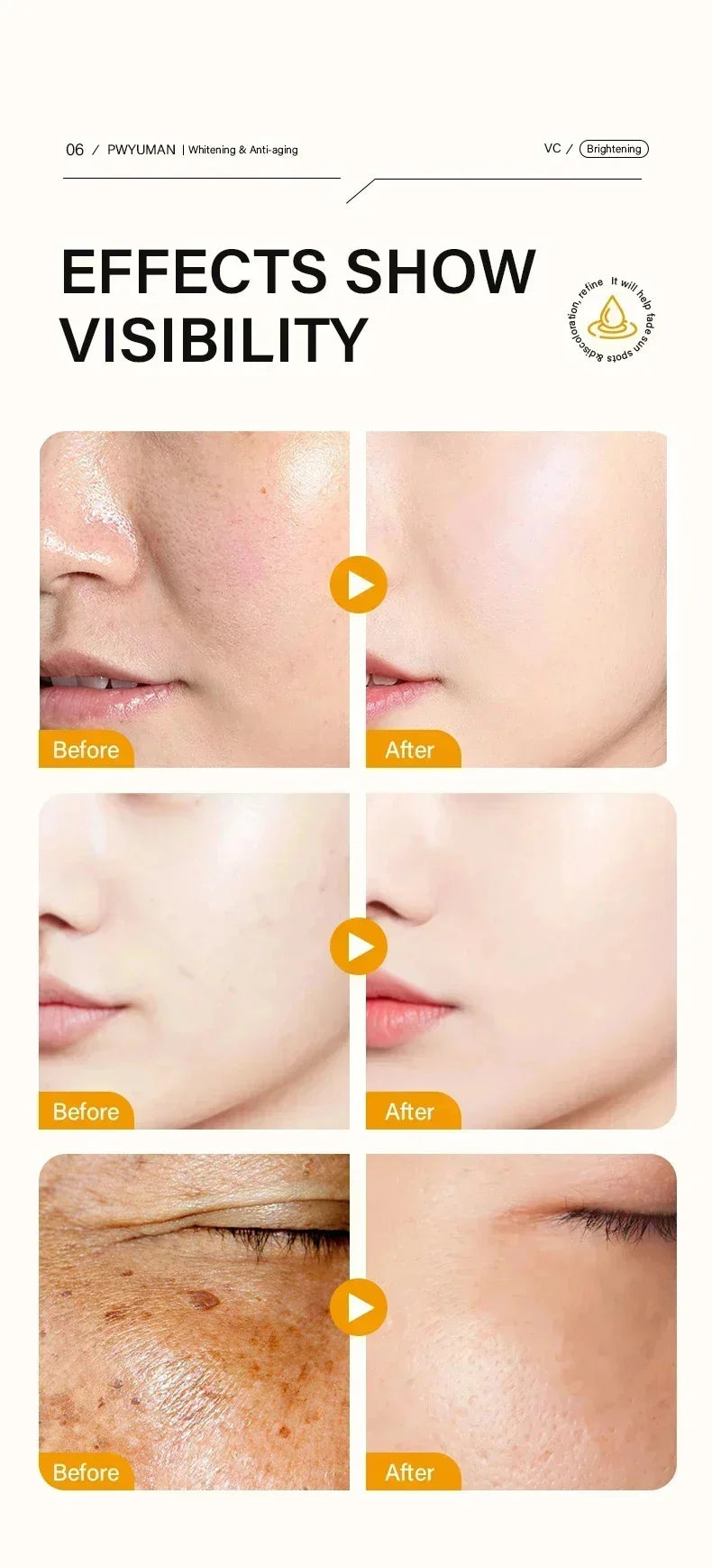 Vitamin C Whitening Freckles Serum Cream Remove Dark Spots Melasma Niacinamide Lighten Melanin Acne Scars Anti-aging Skin Care