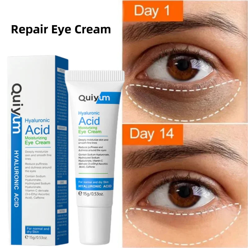 Eye Dark Circles Remover Cream Retinol Anti-aging Serum Remove Eye Bags Puffiness Fade Wrinkles Fine Lines Lift Firm Eye Care