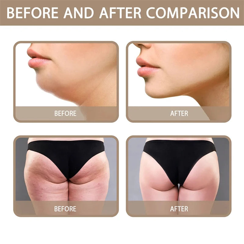 SculptSlim Fat Burning & Cellulite Firming Body Cream