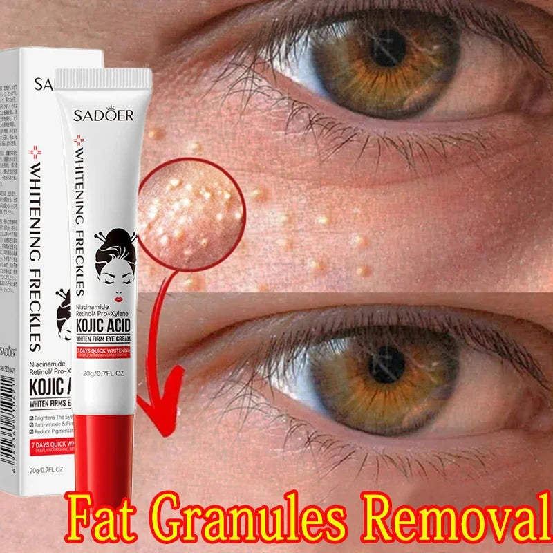 EyePure Fat Granule & Dark Circle Remover Eye Cream