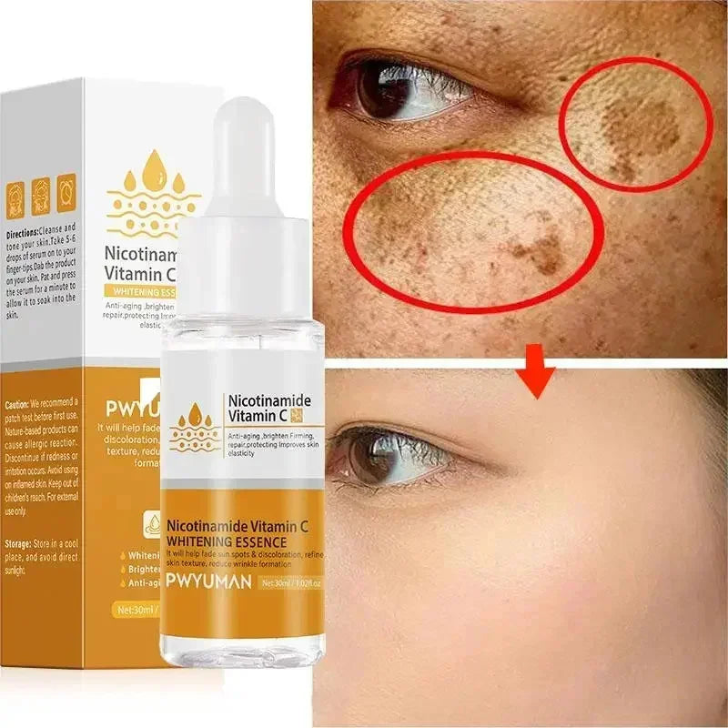 Vitamin C Whitening Freckles Serum Cream Remove Dark Spots Melasma Niacinamide Lighten Melanin Acne Scars Anti-aging Skin Care