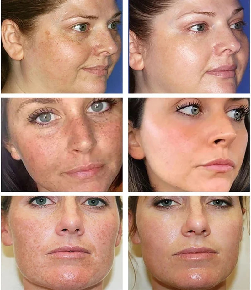 AstroGlow Dark Spot Corrector & Whitening Brightening Cream