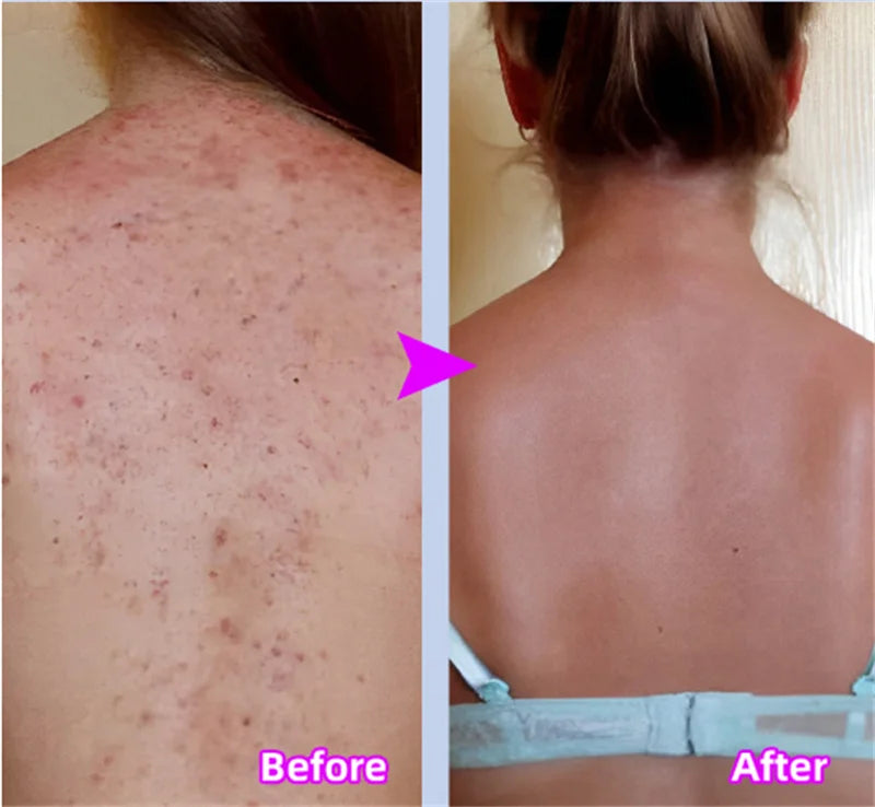 GlowBody Smoothing & Brightening Cream – Strawberry Legs & Rough Skin Fix