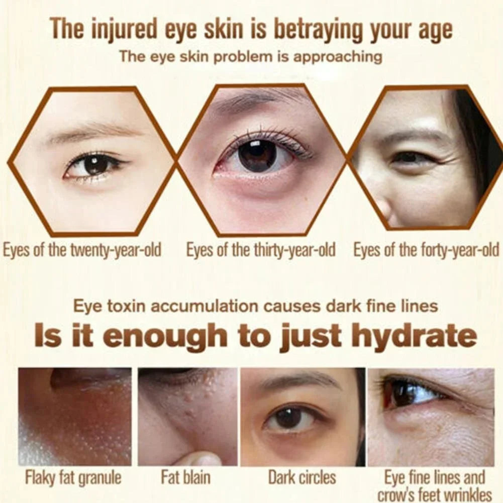 EyePure Fat Granule & Dark Circle Remover Eye Cream