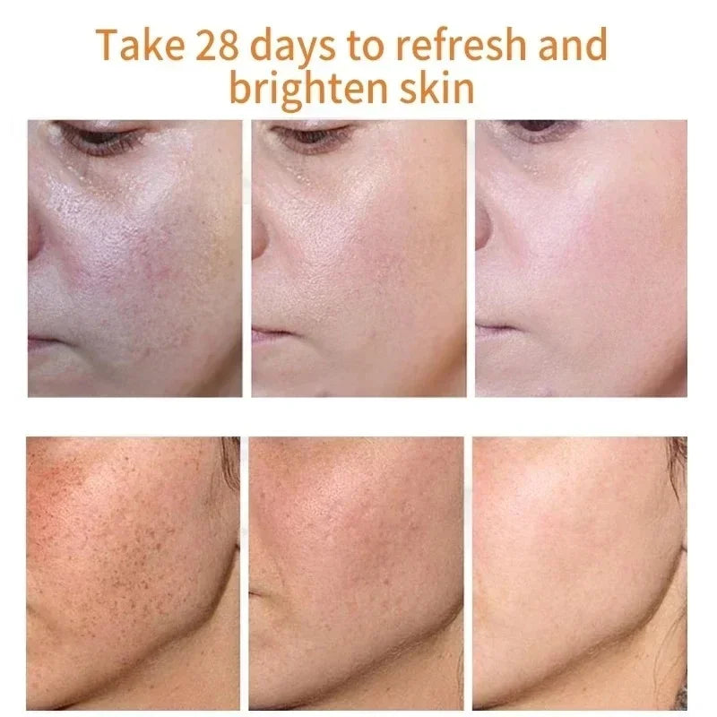 AstroGlow Dark Spot Corrector & Whitening Brightening Cream
