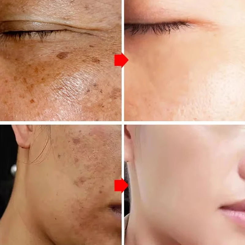 AstroGlow Dark Spot Corrector & Whitening Brightening Cream