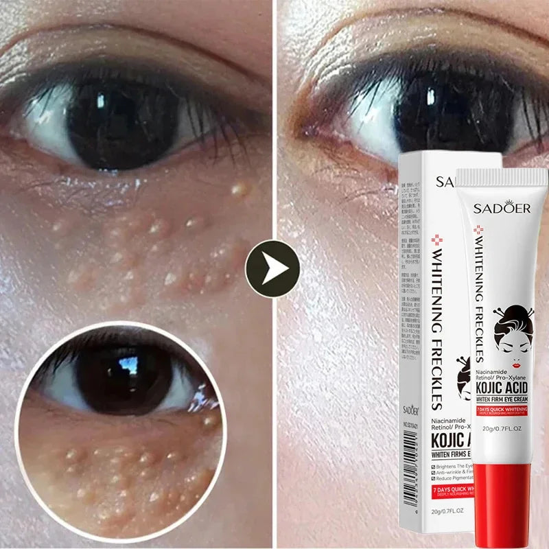 EyePure Fat Granule & Dark Circle Remover Eye Cream
