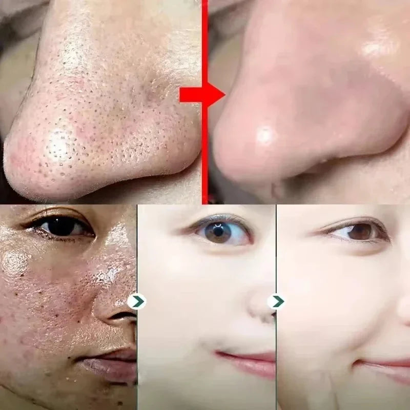 Salicylic Acid Pore Shrinking Mask Quick Elimination Large Pores Remove Blackehead Tighten Face Smooth Skin Korean Care Product