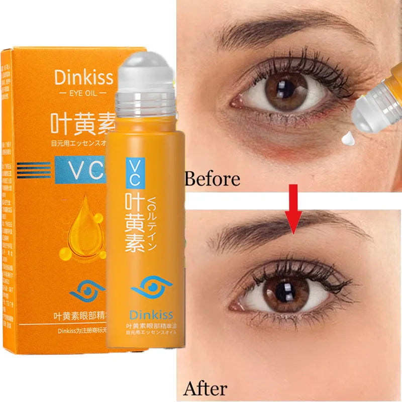 EyeRevive Retinol Dark Circle & Eye Bag Serum