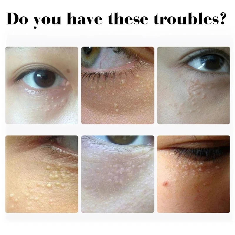 EyePure Fat Granule & Dark Circle Remover Eye Cream