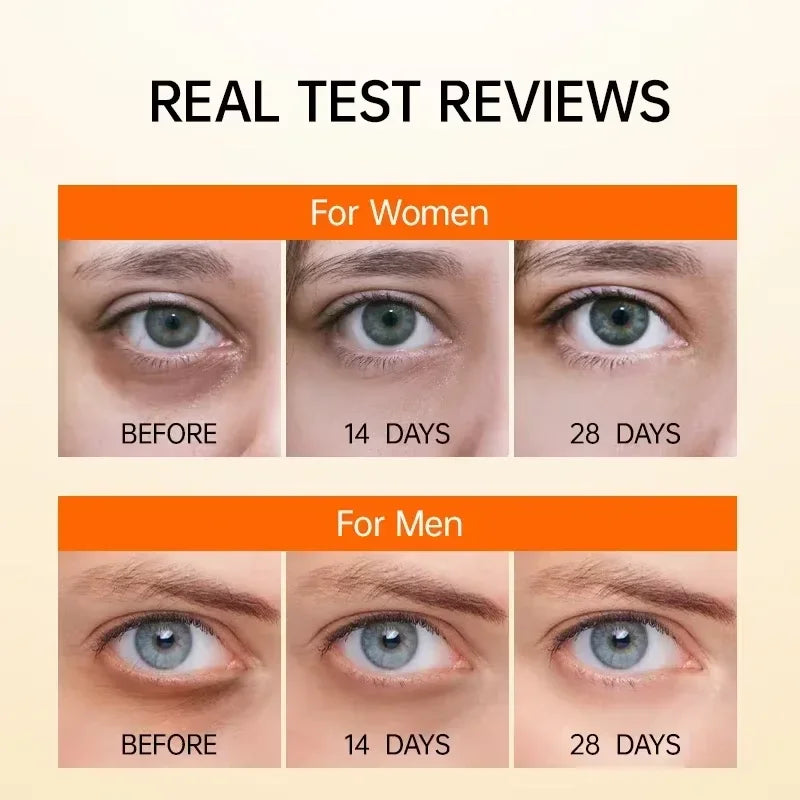 EyeRevive Retinol Dark Circle & Eye Bag Serum