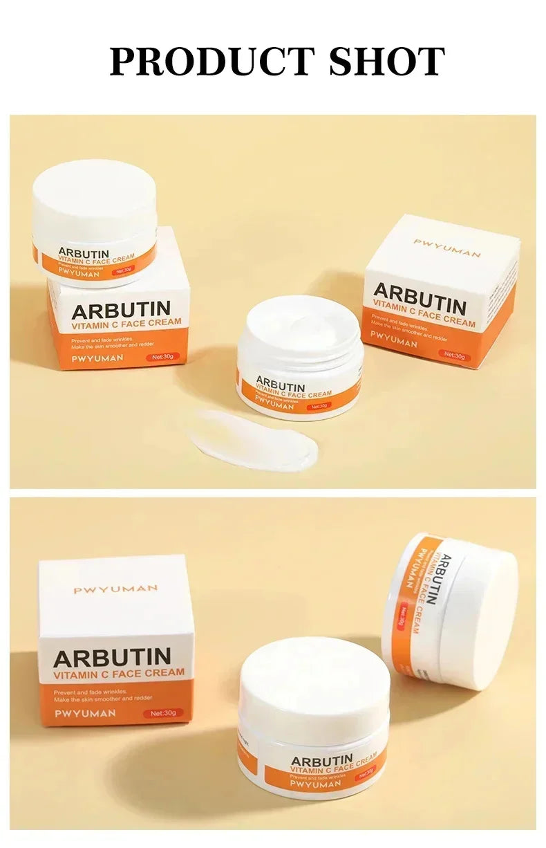Vitamin C Whitening Freckles Serum Cream Remove Dark Spots Melasma Niacinamide Lighten Melanin Acne Scars Anti-aging Skin Care