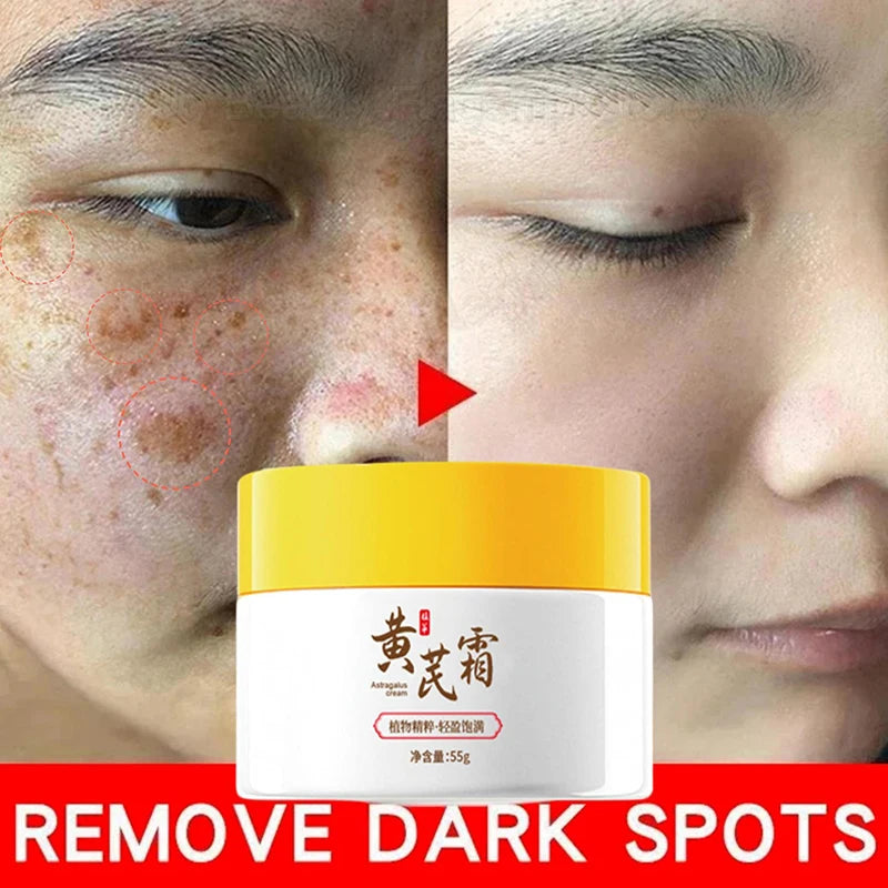 AstroGlow Dark Spot Corrector & Whitening Brightening Cream