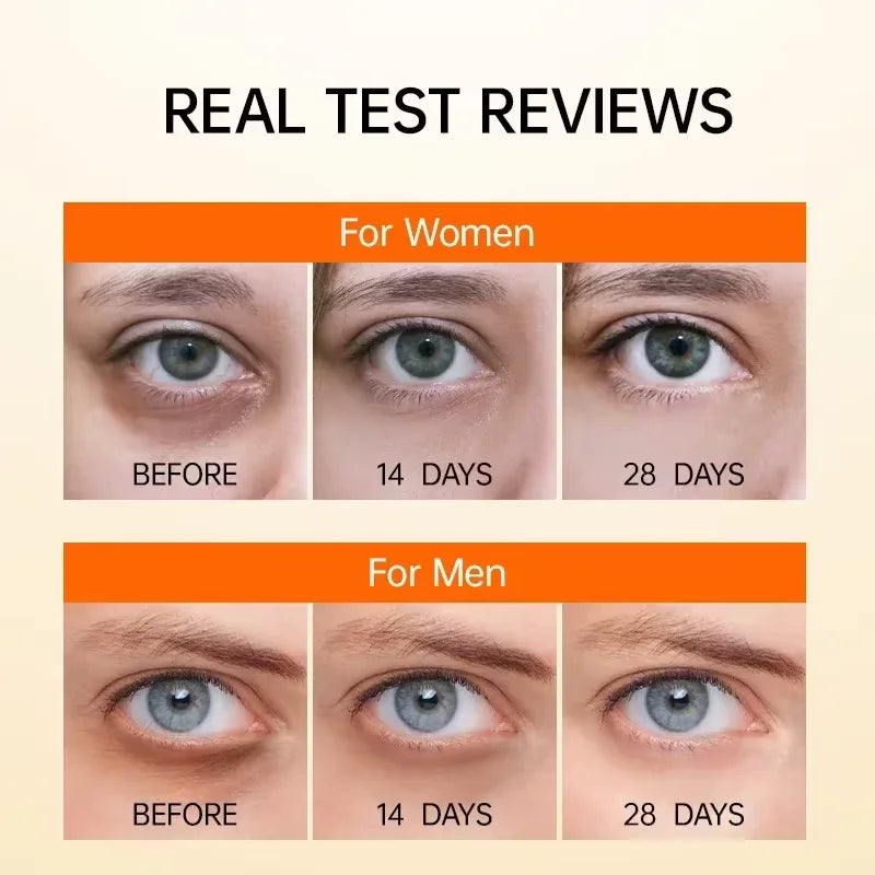 EyeRevive Retinol Dark Circle & Eye Bag Serum