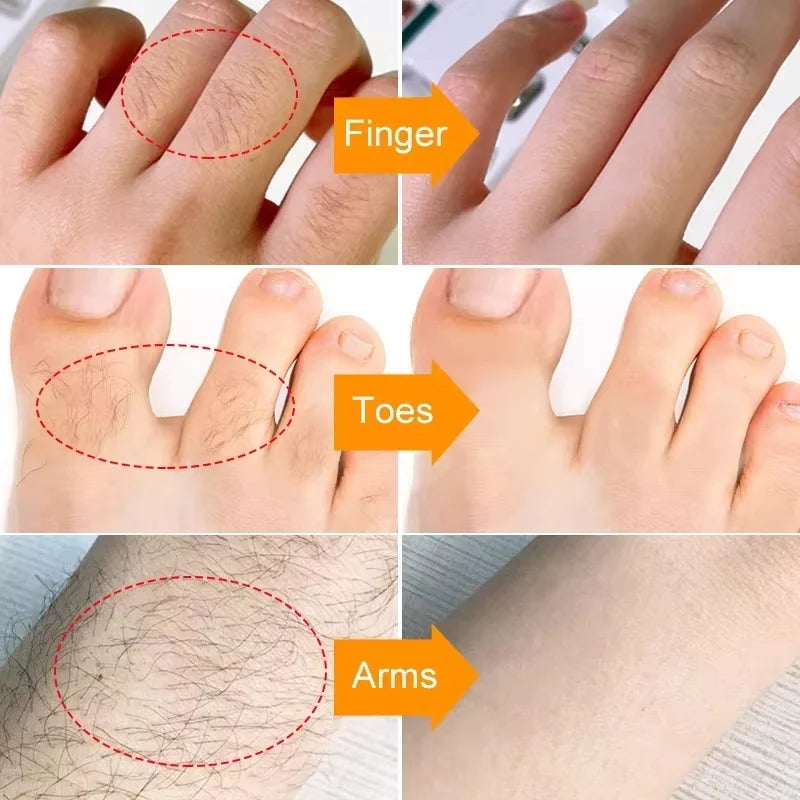 Fast Painless Hair Removal Cream Aloe Moisturizing Gel Hair Growth Inhibitor Lip Face Arm Armpit Leg Permanent Depilatory