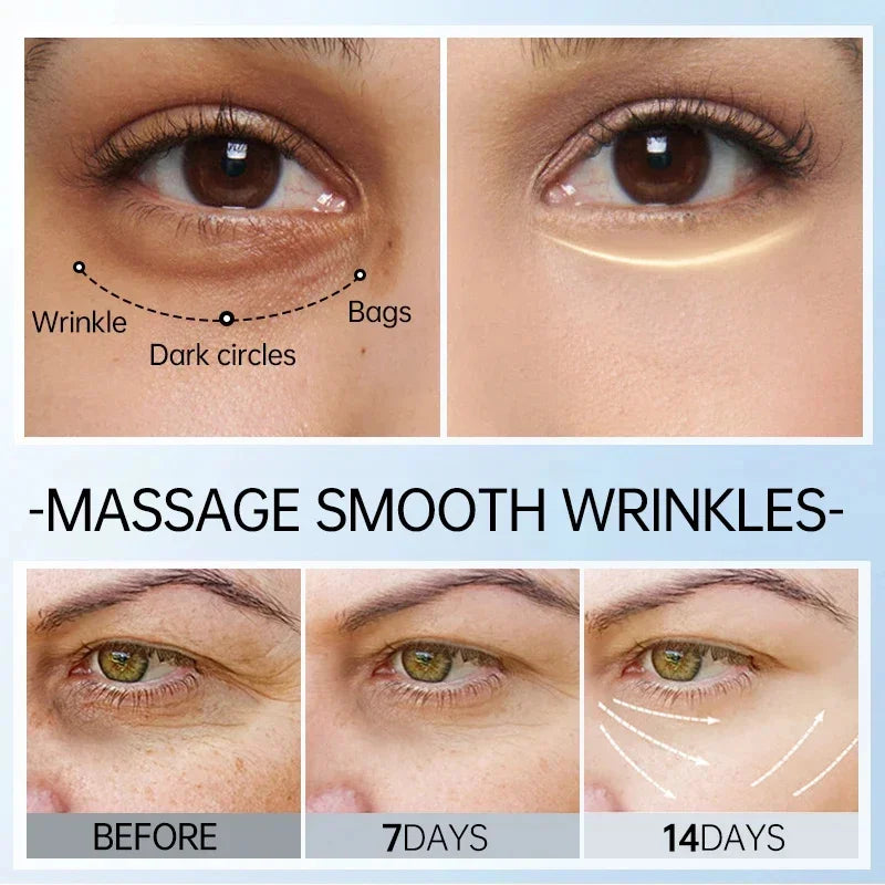 Eye Dark Circles Remover Cream Retinol Anti-aging Serum Remove Eye Bags Puffiness Fade Wrinkles Fine Lines Lift Firm Eye Care