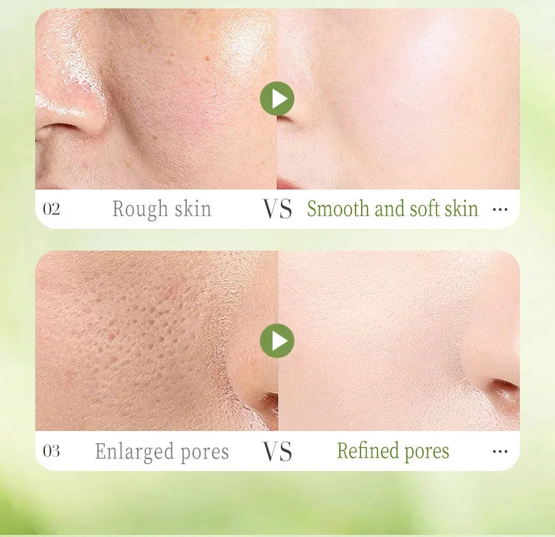 Salicylic Acid Pore Shrinking Mask Quick Elimination Large Pores Remove Blackehead Tighten Face Smooth Skin Korean Care Product