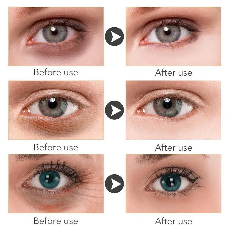 Eye Dark Circles Remover Cream Retinol Anti-aging Serum Remove Eye Bags Puffiness Fade Wrinkles Fine Lines Lift Firm Eye Care