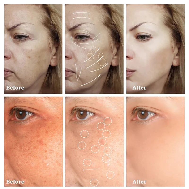 AstroGlow Dark Spot Corrector & Whitening Brightening Cream
