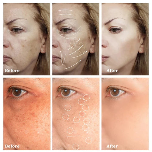 AstroGlow Dark Spot Corrector & Whitening Brightening Cream