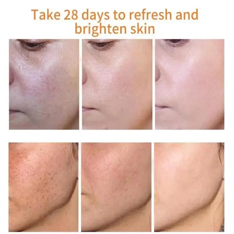 Powerful Spot-removing Whiten Cream Brighten Skin Fast Eliminates Melanin Pigmentation Melasma Dark Spots Moisturize Beauty Gel