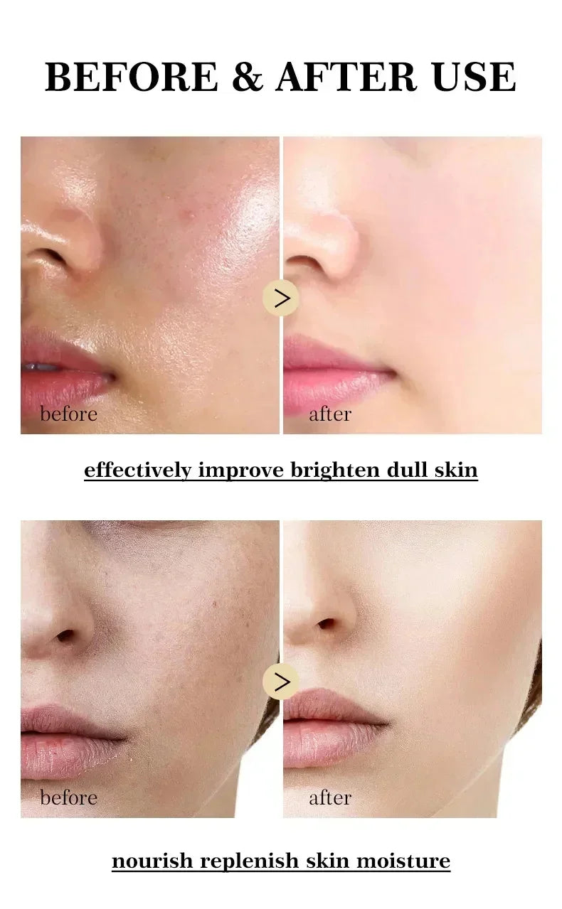 Vitamin C Whitening Freckles Serum Cream Remove Dark Spots Melasma Niacinamide Lighten Melanin Acne Scars Anti-aging Skin Care