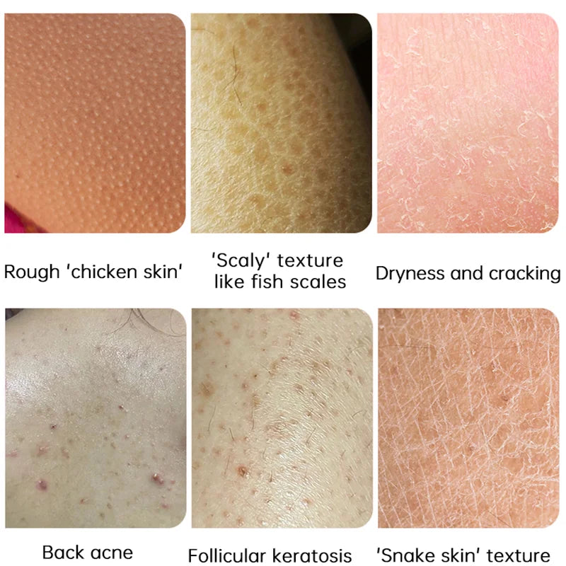 GlowBody Smoothing & Brightening Cream – Strawberry Legs & Rough Skin Fix